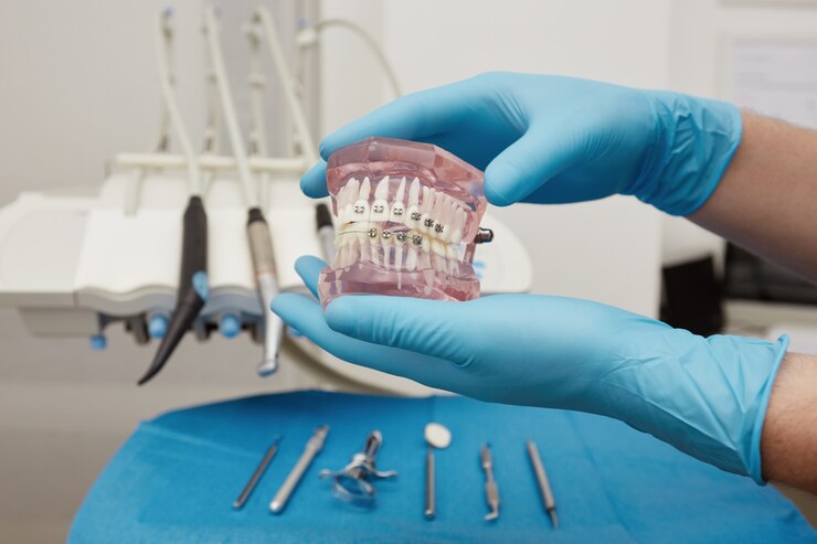 Transform Your Smile: Dental Veneers In Tucson, AZ